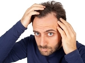 Man Hair Loss